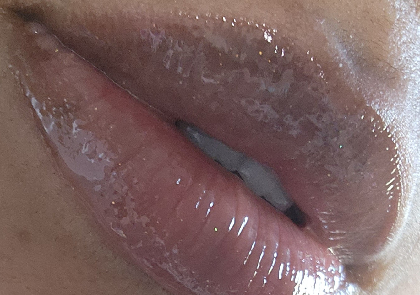 Glosses